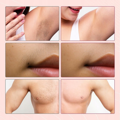 Depilator IPL laserowy