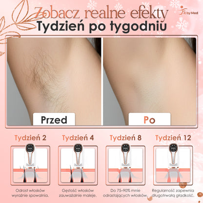 Depilator IPL laserowy